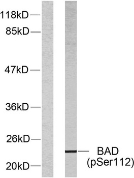 Bad (phospho Ser112) rabbit pAb