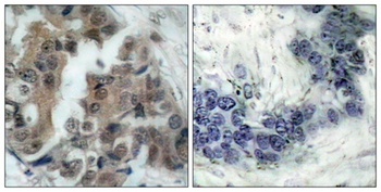 Bad (phospho-Ser136) antibody