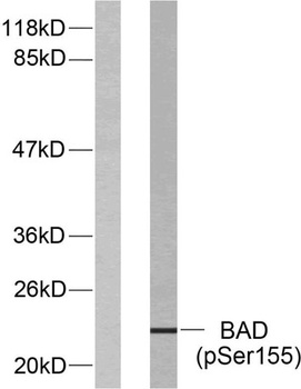 Bad (phospho-Ser155) antibody