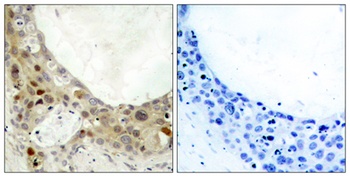 Bcl-2 (phospho Ser70) rabbit pAb