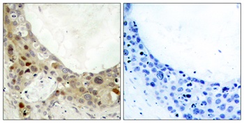 Bcl-2 (phospho-Ser70) antibody