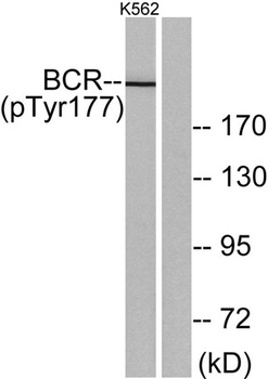 Bcr (phospho Tyr177) rabbit pAb