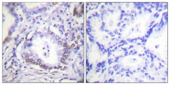 C/EBP beta (phospho-Thr235) antibody