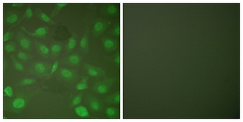 C/EBP beta (phospho-Thr235) antibody