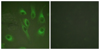 Calnexin (phospho-Ser583) antibody