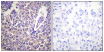 Calnexin (phospho-Ser583) antibody