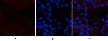 Catenin-β (phospho Ser37) rabbit pAb