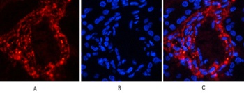 Catenin-beta (phospho-Ser37) antibody