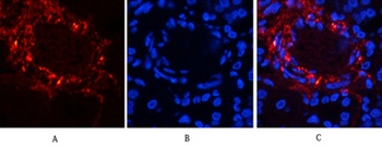 Catenin-beta (phospho-Ser37) antibody