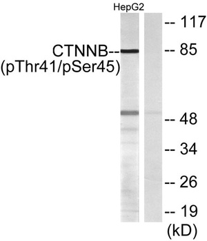 Catenin-β (phospho Thr41/S45) rabbit pAb