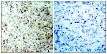 Cdc2 (phospho-Thr161) antibody