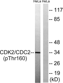 Cdc2 (phospho-Thr161) antibody