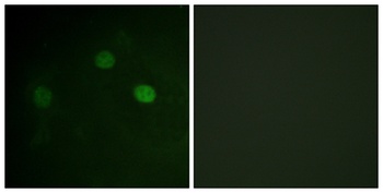 Cdk1/2/3 (phospho Thr14) rabbit pAb