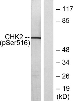 Chk2 (phospho-Ser516) antibody