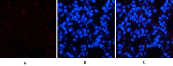 Chk2 (phospho Thr68) rabbit pAb