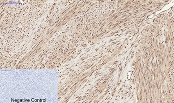 Chk2 (phospho Thr68) rabbit pAb