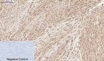 Chk2 (phospho-Thr68) antibody