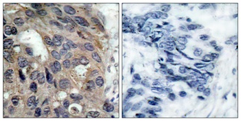 c-Src (phospho-Tyr529) antibody