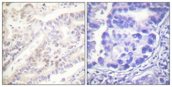 Cyclin B1 (phospho Ser126) rabbit pAb