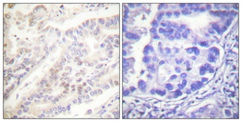 Cyclin B1 (phospho-Ser126) antibody