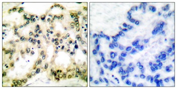 Cyclin B1 (phospho-Ser126) antibody