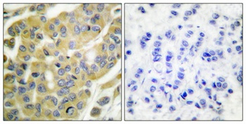 Cytokeratin 8 (phospho-Ser73) antibody