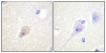 DARPP-32 (phospho-Thr75) antibody