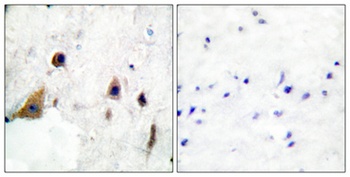 DARPP-32 (phospho-Thr75) antibody