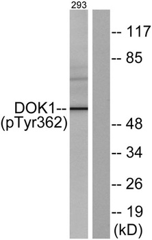 Dok-1 (phospho-Tyr362) antibody