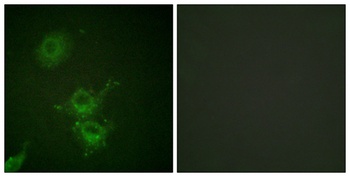 EGFR (phospho Thr693) rabbit pAb