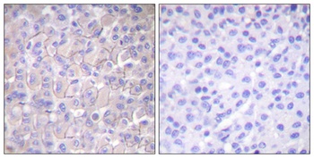 EGFR (phospho Thr693) rabbit pAb