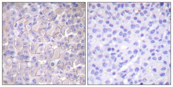 EGFR (phospho-Thr693) antibody