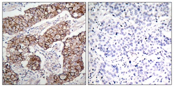 EGFR (phospho Tyr1092) rabbit pAb