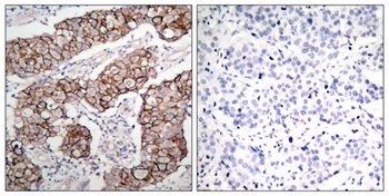 EGFR (phospho-Tyr1092) antibody