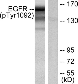 EGFR (phospho-Tyr1092) antibody