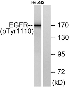 EGFR (phospho Tyr1110) rabbit pAb