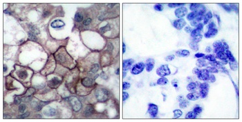 EGFR (phospho Tyr1197) rabbit pAb