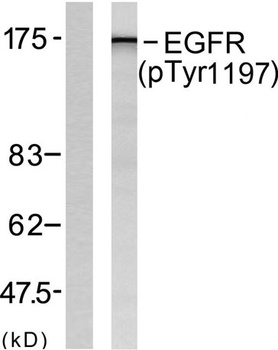 EGFR (phospho-Tyr1197) antibody