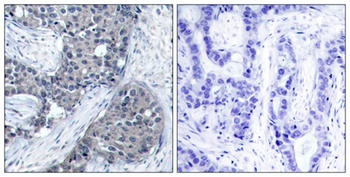 eIF4E (phospho Ser209) rabbit pAb