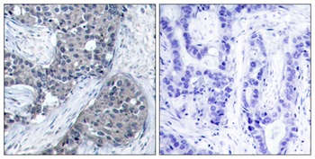 eIF4E (phospho-Ser209) antibody