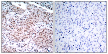 ERα (phospho Ser104) rabbit pAb