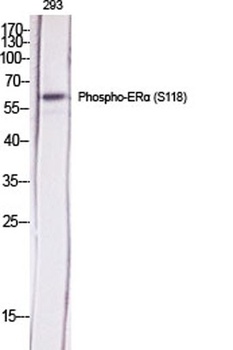 ERα (phospho Ser118) rabbit pAb