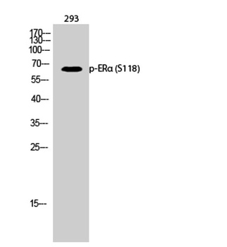 ERalpha (phospho-Ser118) antibody