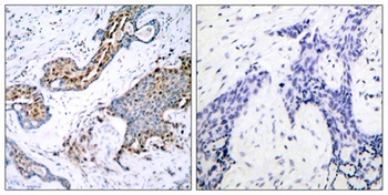 ERalpha (phospho-Ser118) antibody