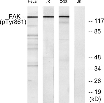 FAK (phospho Tyr861) rabbit pAb