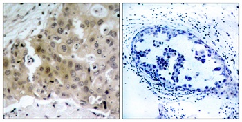 Flk-1/VEGFR2 (phospho Tyr1175) rabbit pAb