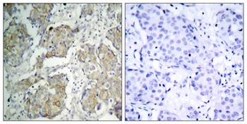 Flk-1/VEGFR2 (phospho Tyr1214) rabbit pAb