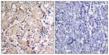 FoxO1 (phospho Ser319) rabbit pAb Antibody
