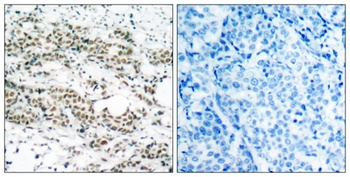 FoxO4 (phospho Ser197) rabbit pAb