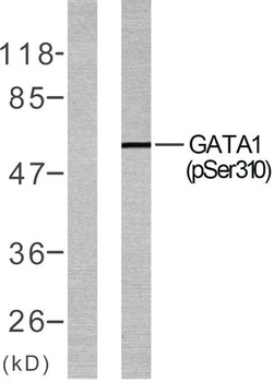 GATA-1 (phospho-Ser310) antibody